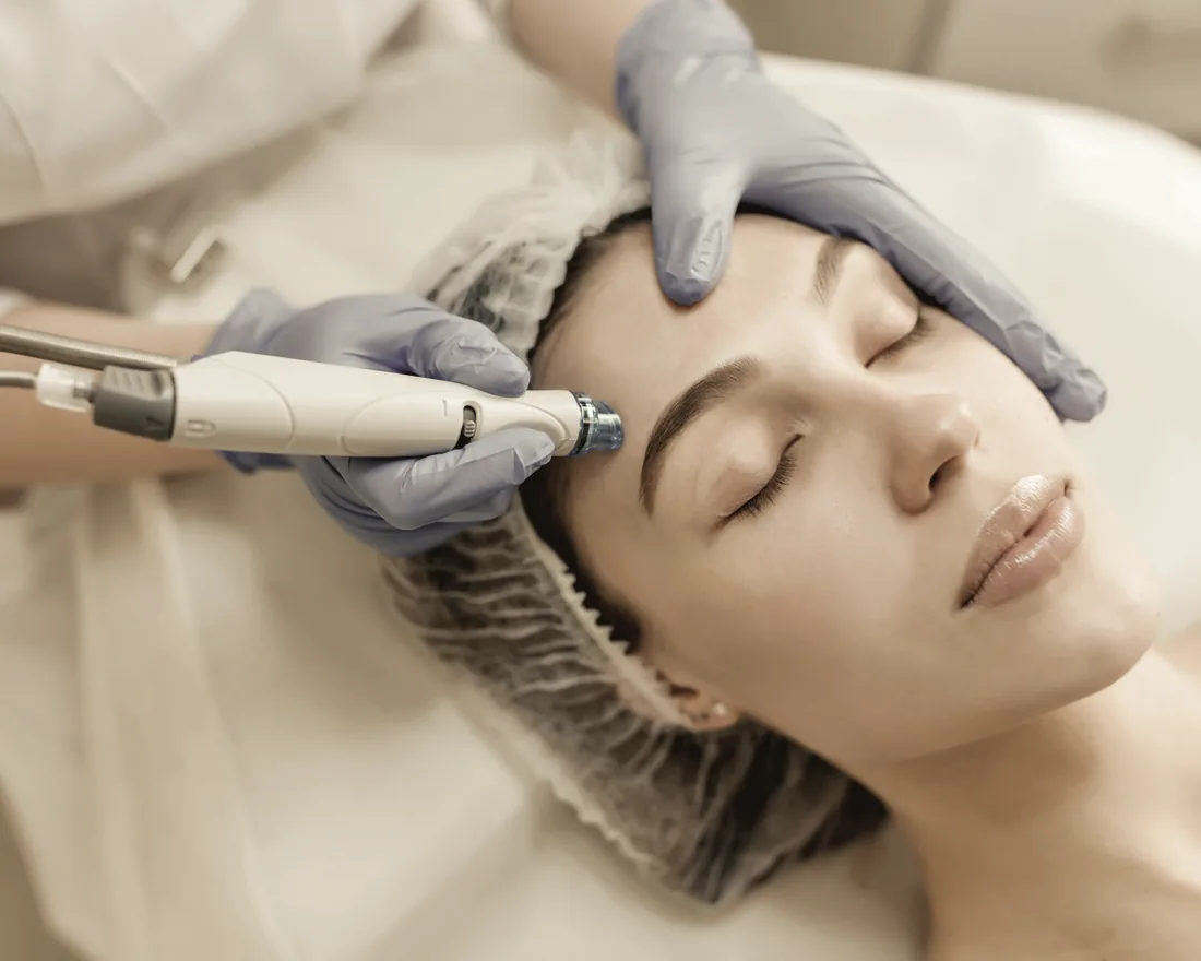 Microneedling-utrustning i klinikmiljö