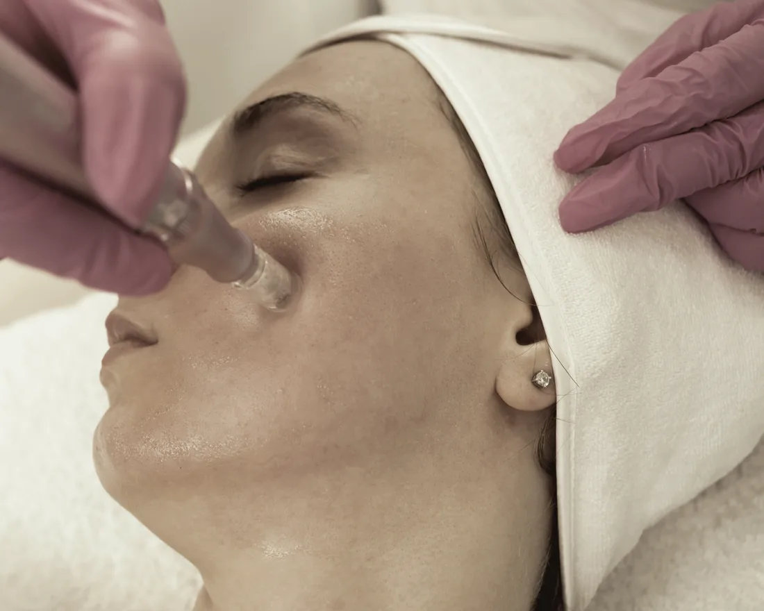 OxyGeneo-behandling med handstycke mot huden