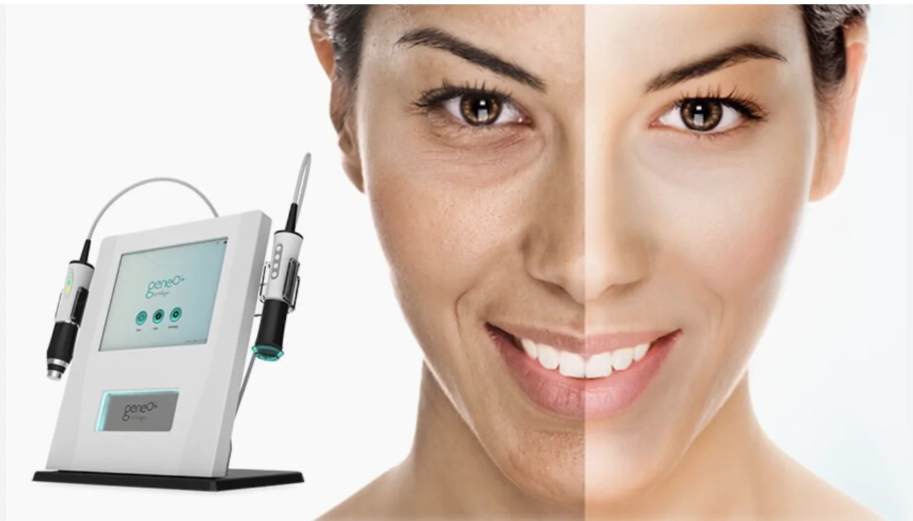 OxyGeneo geneO+ med resultat före och efter Super Facial